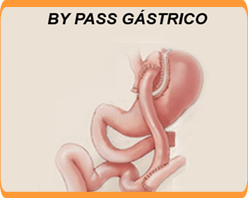 Slider image (2) C.I.O.L: Centro Integral de Obesidad y Laparoscopia | Spanish Center